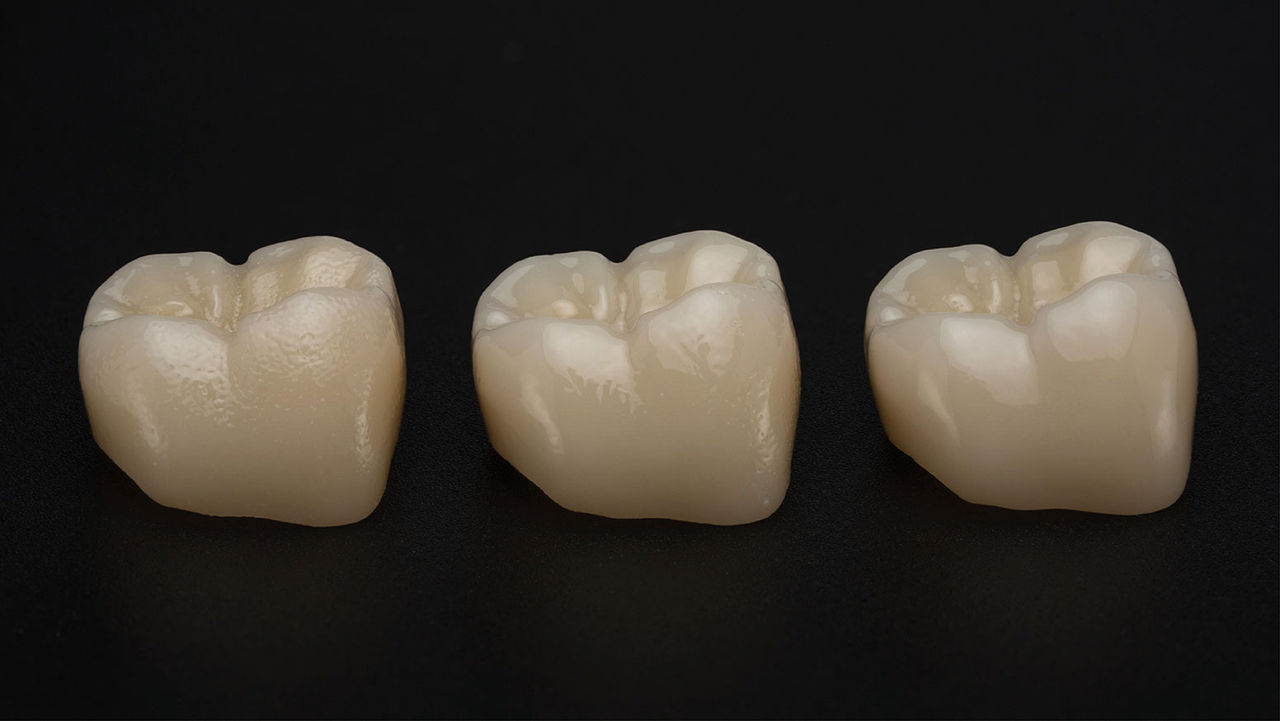 Gloss vs. Matte Crown Finish: What Dentists Actually Preferred 