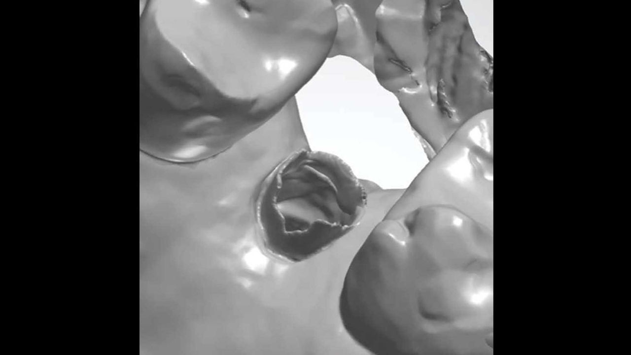 Reflective surfaces, especially titanium scan bodies