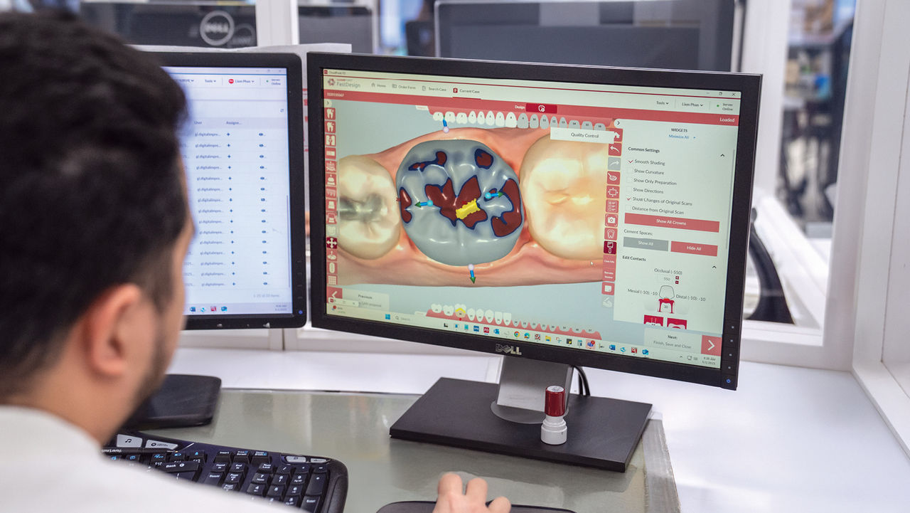 Technology in Dentistry: What Sets a Digital Dental Lab Apart