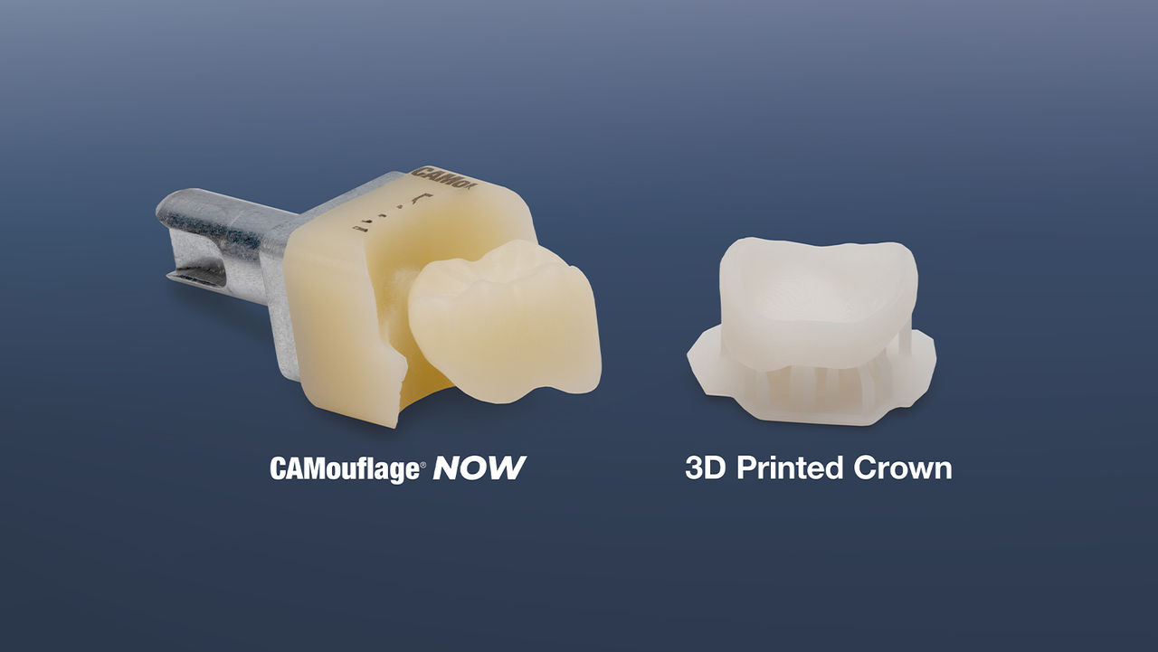 CAMouflage® NOW: A Milled Composite Alternative to 3D Printed Crowns