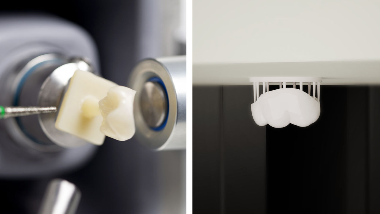 3D Dental Printing vs. Chairside Milling: Which Method Makes the Best Crowns?