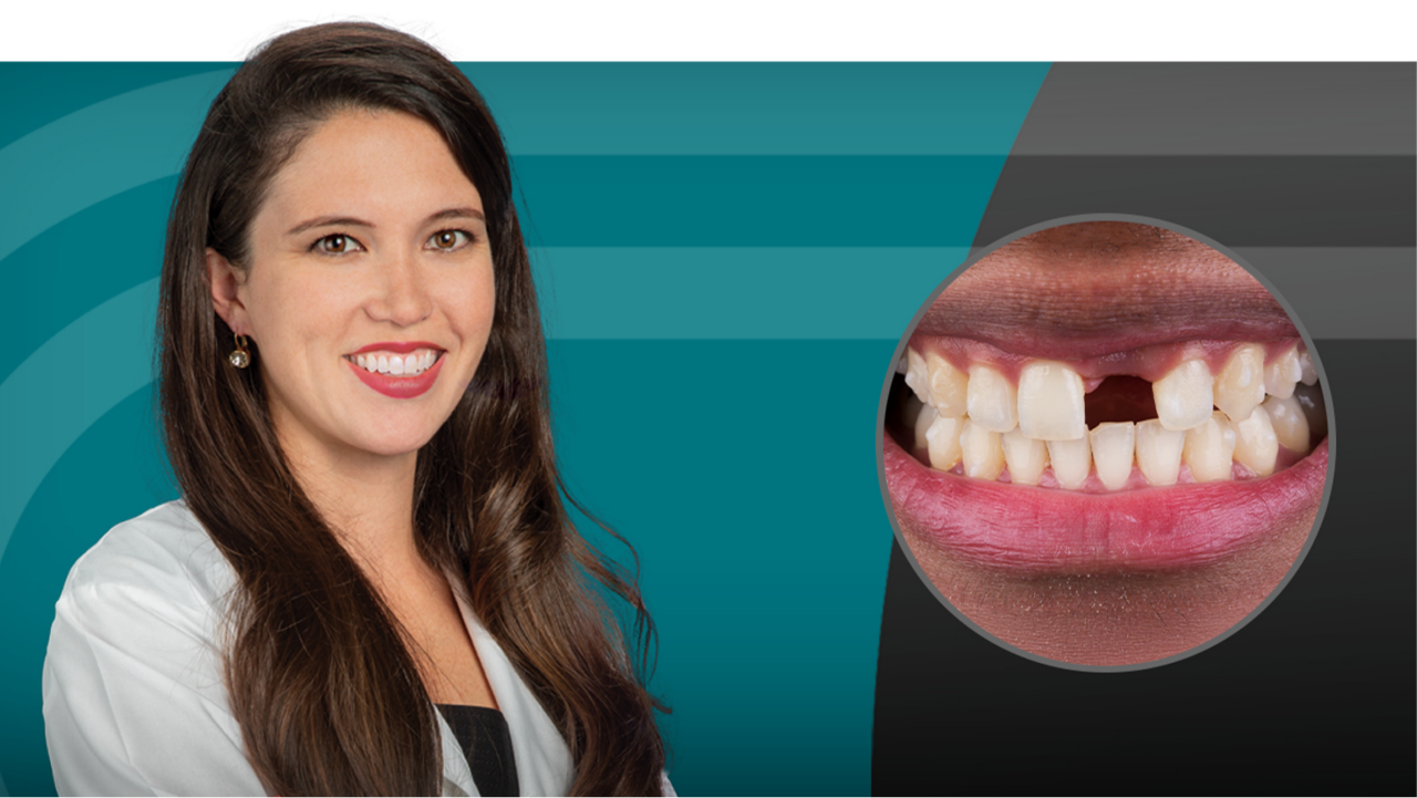 Dental health close-up with professional