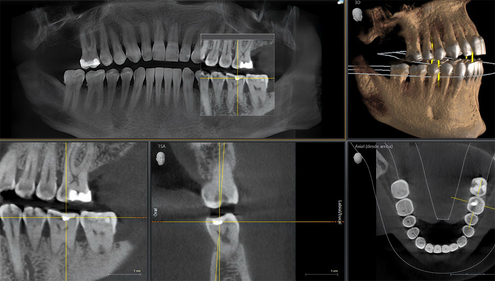 Oral Anatomy
