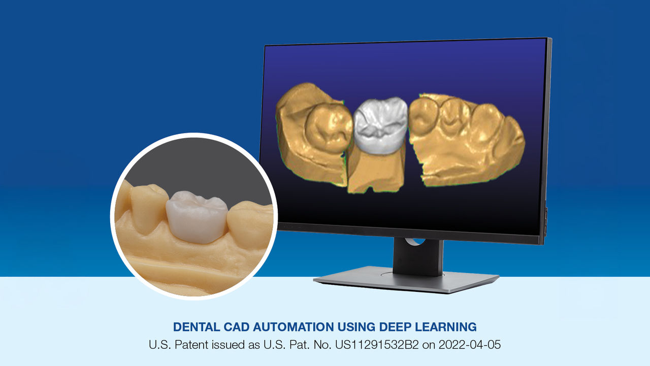 How Glidewell Has Always Moved Ahead of the Industry