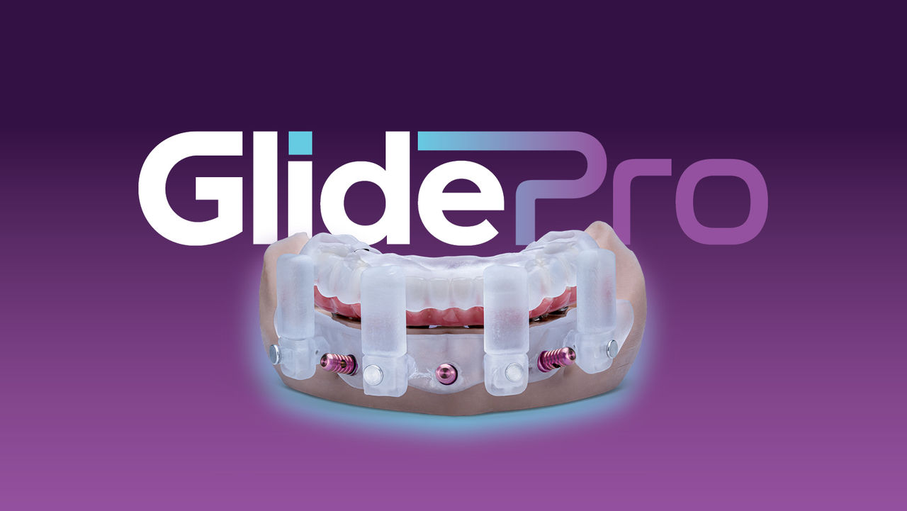 How Glidewell Is Simplifying Full-Arch Implant Workflows