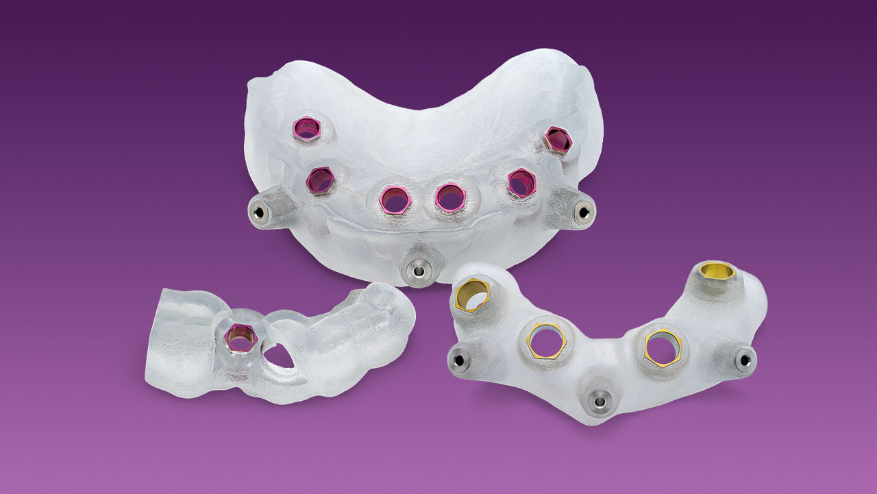 Guided Implant Surgery