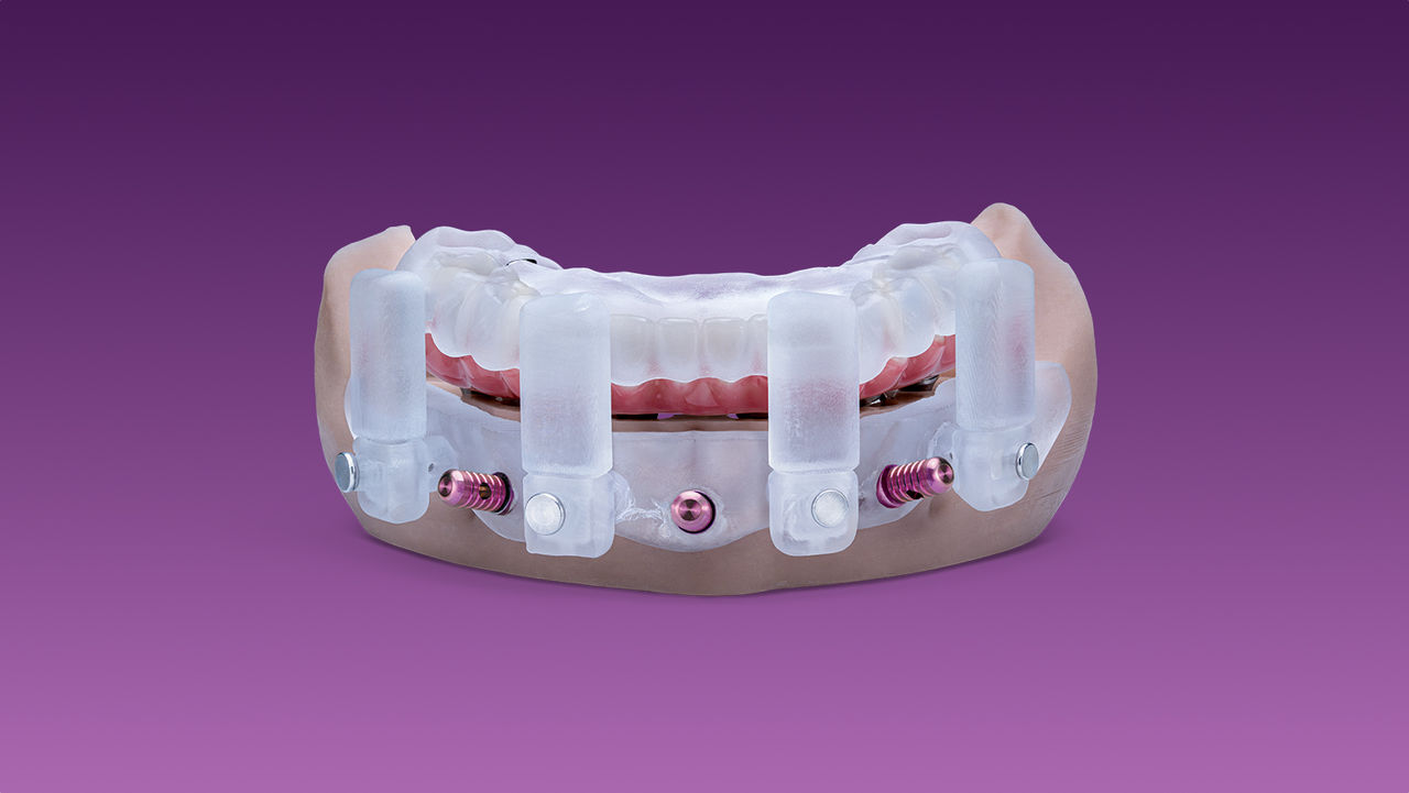 Stackable Surgical Guide System