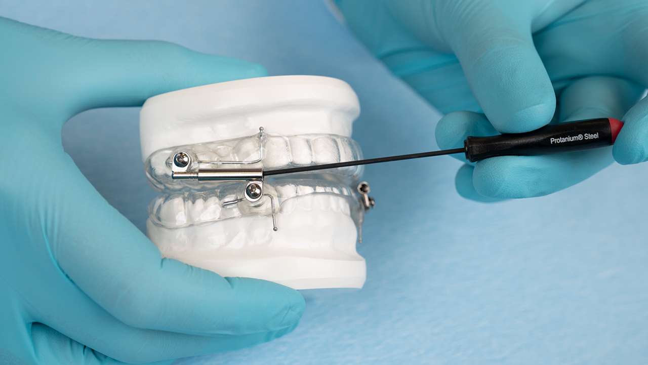 The OASYS Hinge Appliance can be adjusted in or out of the mouth, depending on the clinician’s choice. The scale on the arms of the appliance makes symmetrical advancement easy.