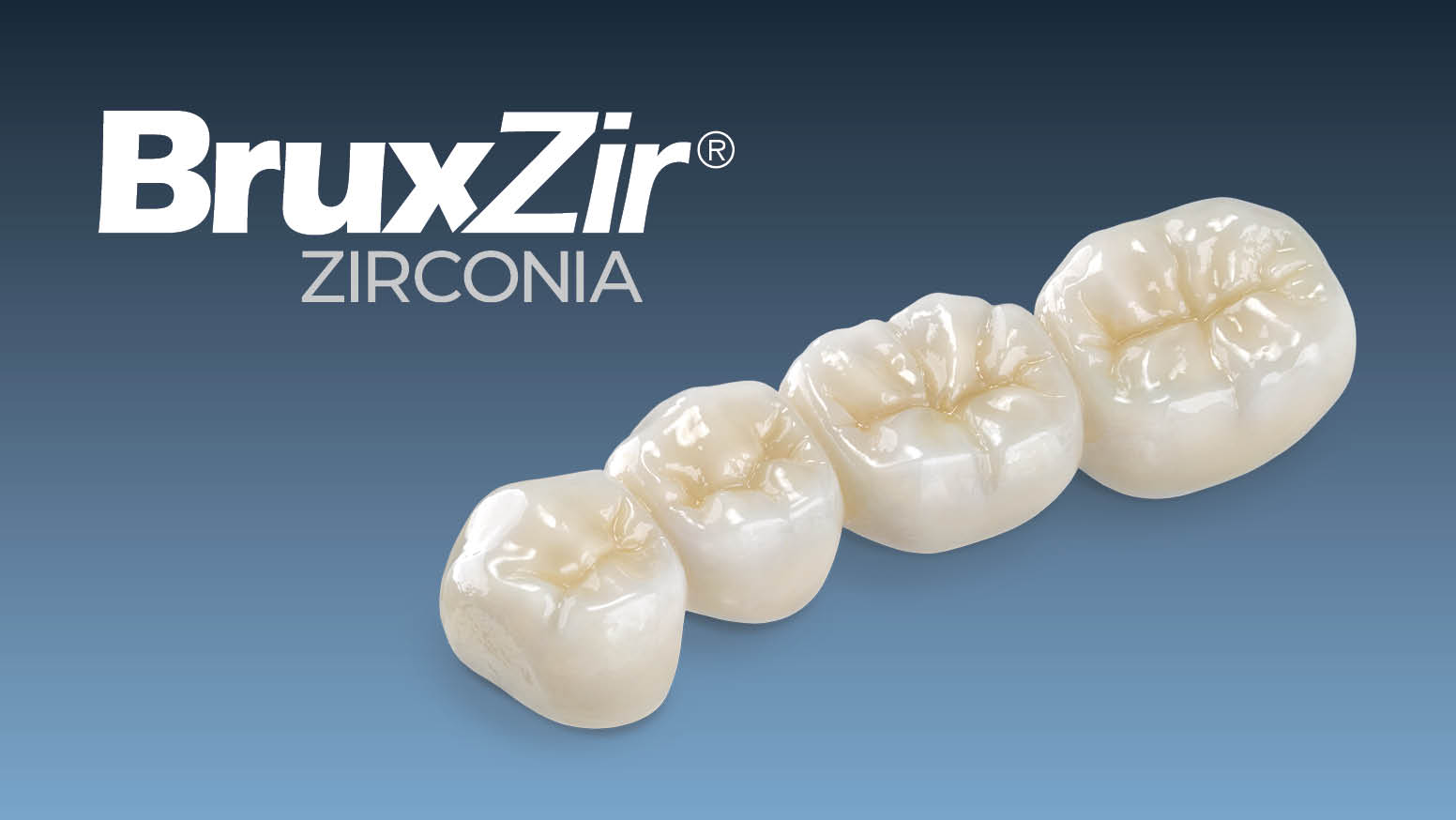 How to Choose Between Zirconia Crowns and IPS e.max® Crowns Glidewell