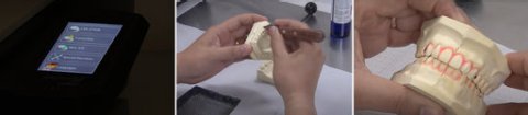 How to Make an EMA® Appliance In-Office | Glidewell