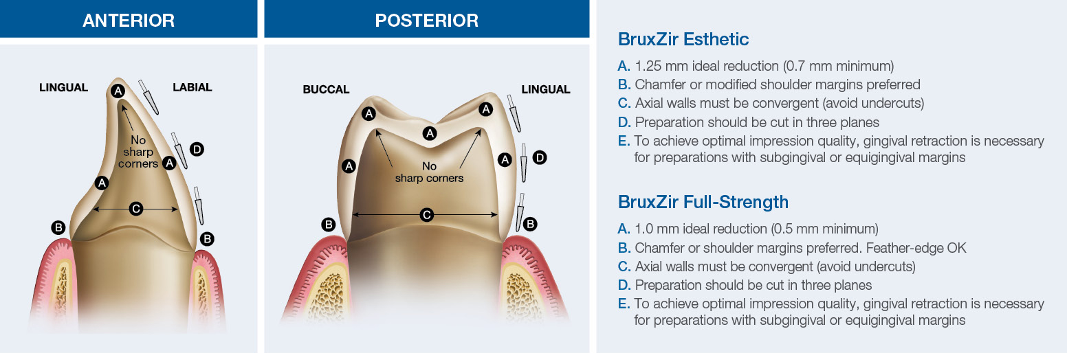 How to Prep and Cement Zirconia Crowns Glidewell