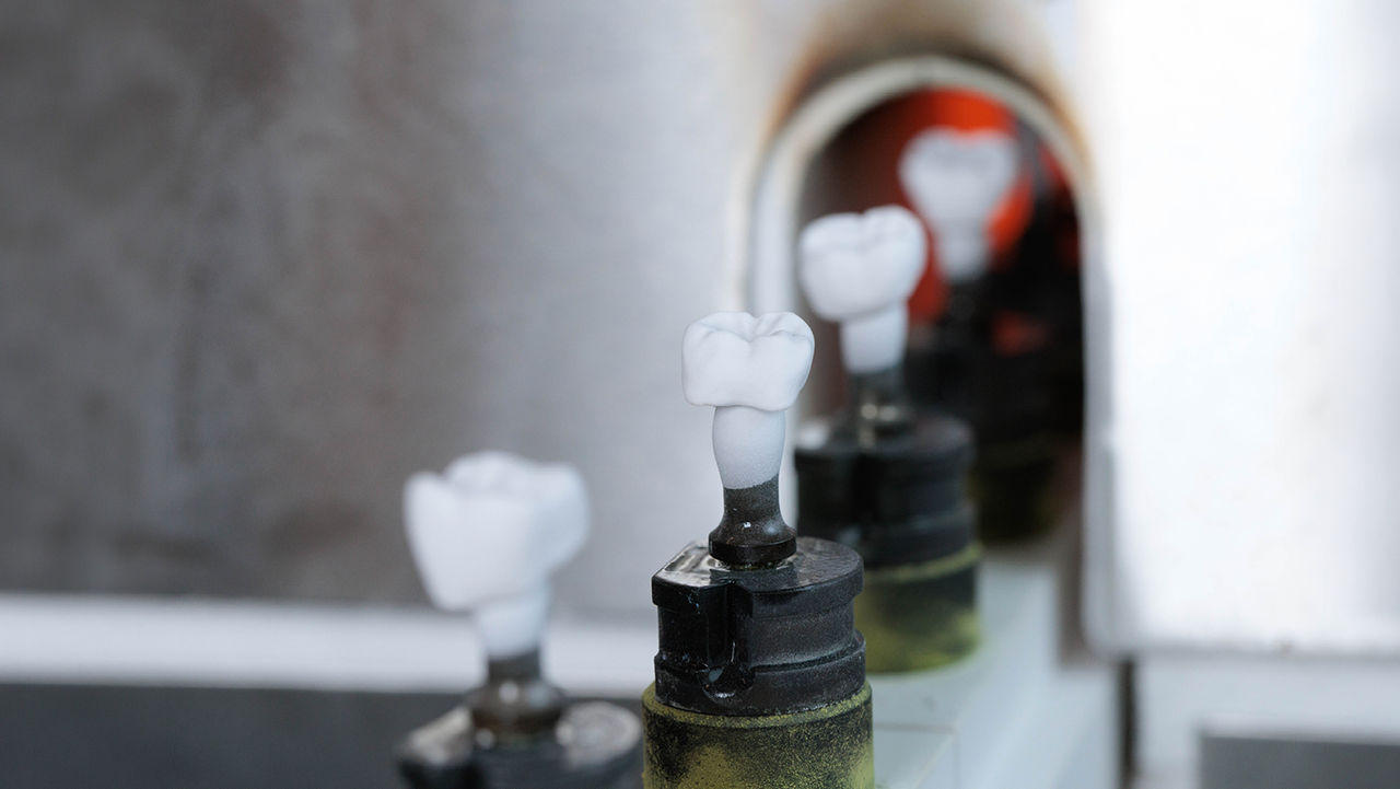 How Glidewell Approaches Crown Consistency and Reduces Remake Rates[