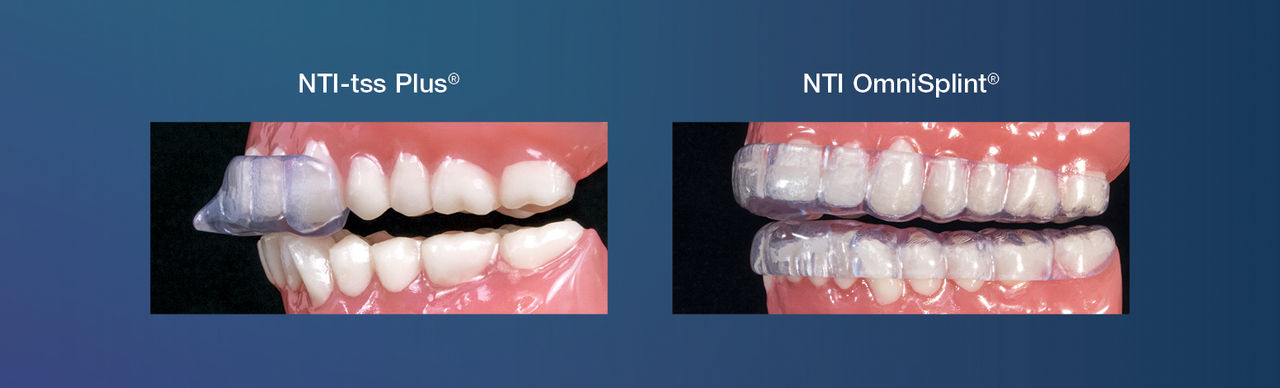 In addition to minimizing joint strain and load and protecting dentition from wear, the NTI-tss Plus and NTI OmniSplint reduce jaw clenching intensity, which is a source of headaches and migraines. 