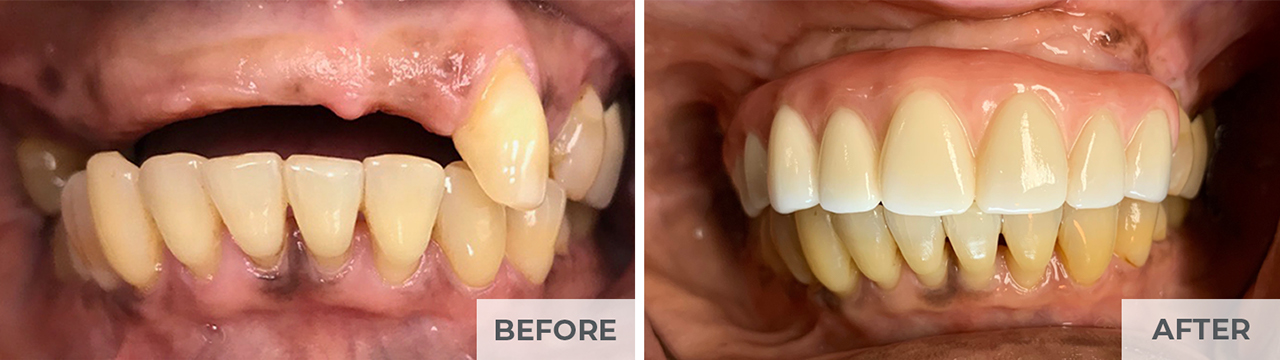 11a-Jones-1552x437-before-n-after