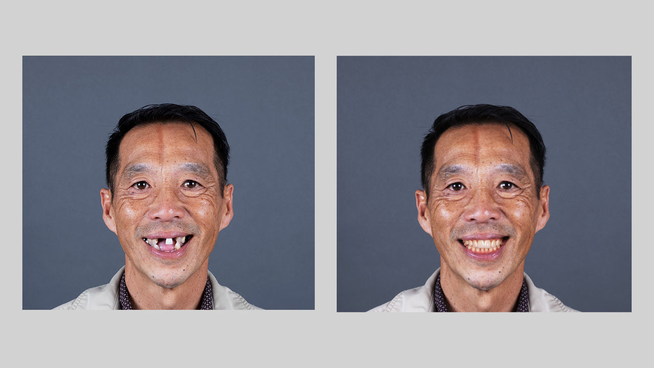 It’s actually how this patient will look