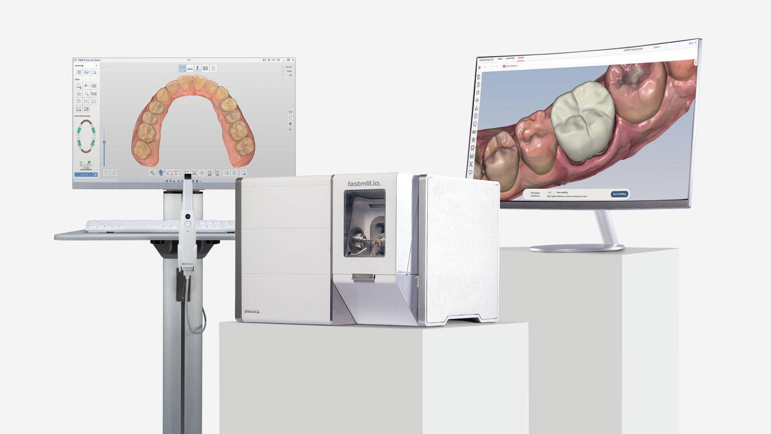 StepByStep Digital Dentistry Workflow with glidewell.io™ Glidewell