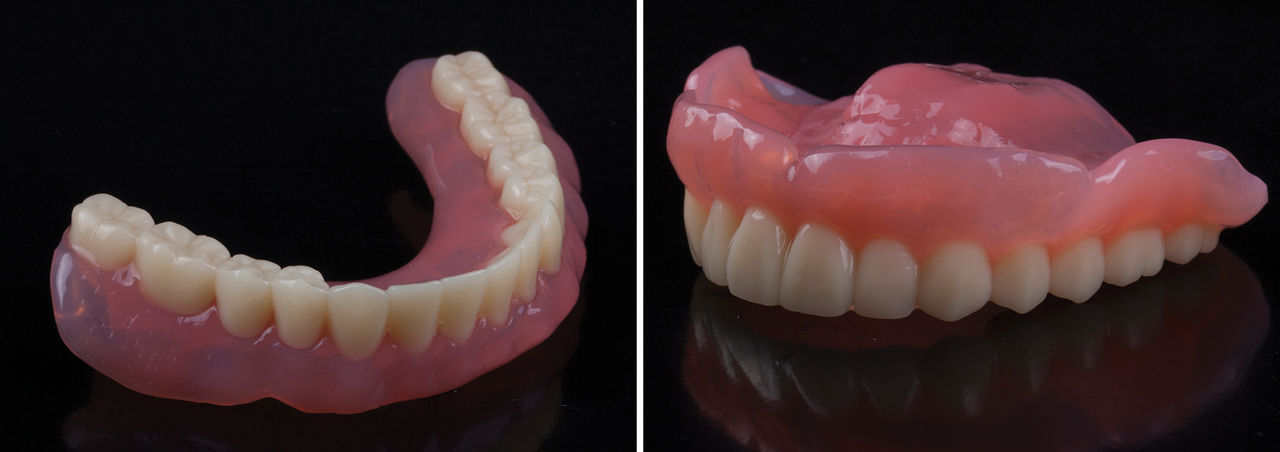 The Benefits of 3D-Printed Dentures - Sub Image 1