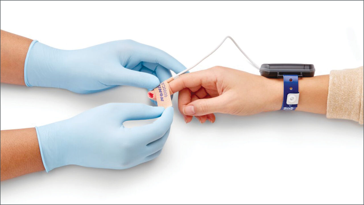 Home sleep test with chain-of-custody band. Photo courtesy of Nonin Medical, Inc.