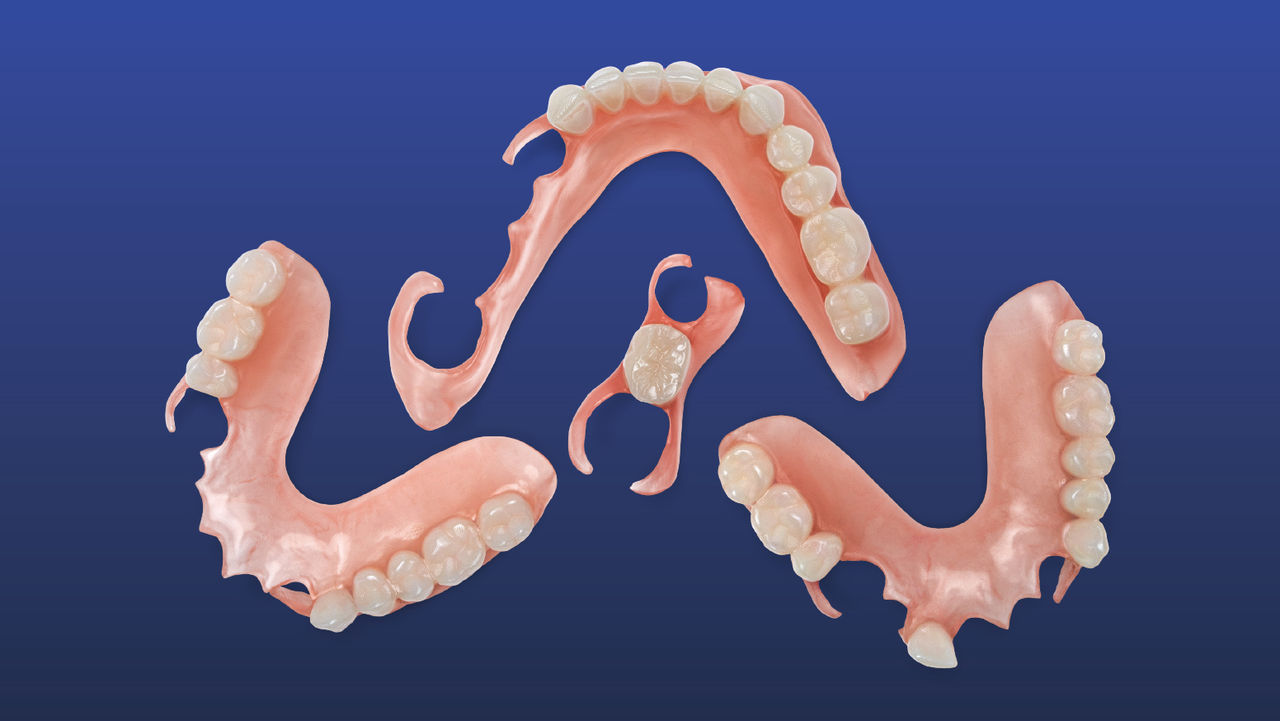 Why 3D Flexible Partials Are the Future