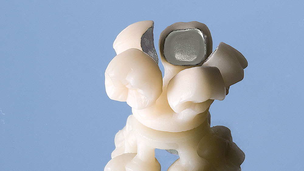 CAD/CAM Technology
