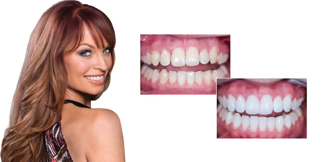 Foundation for a Successful Smile Makeover Hero Image