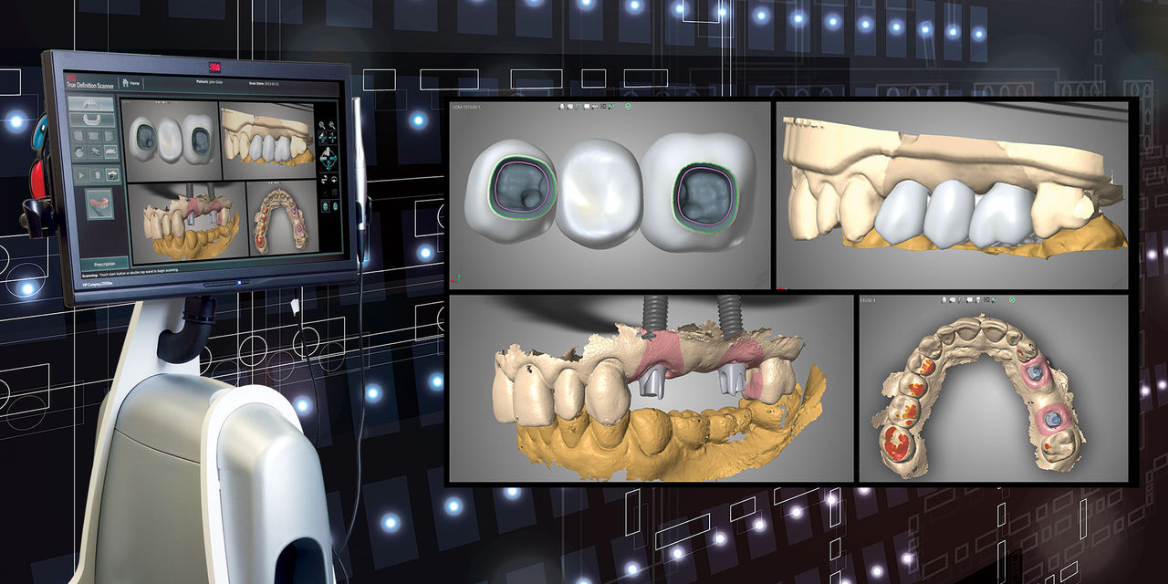 Digital Scanning of Implants Cover Image