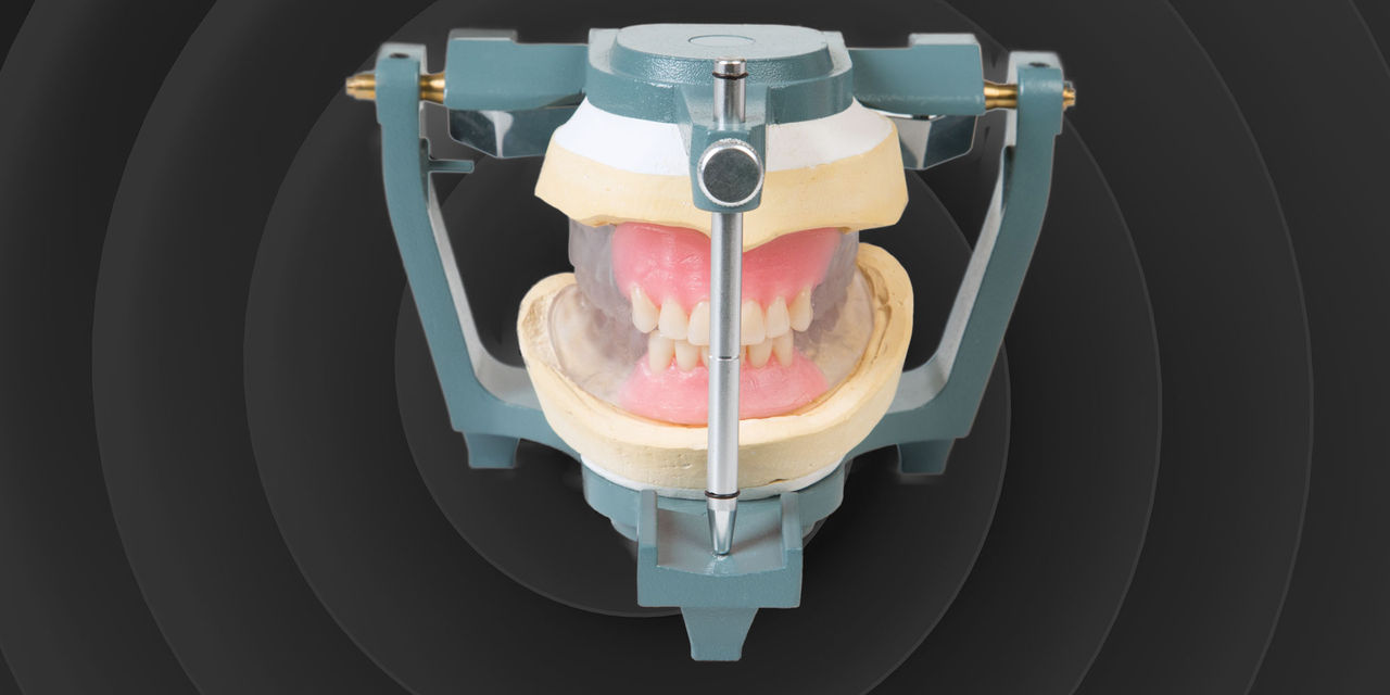 Digital Spin on Traditional Dentures Cover Image