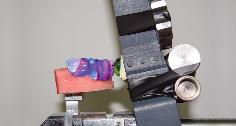 An Evaluation of Mouthguard Materials