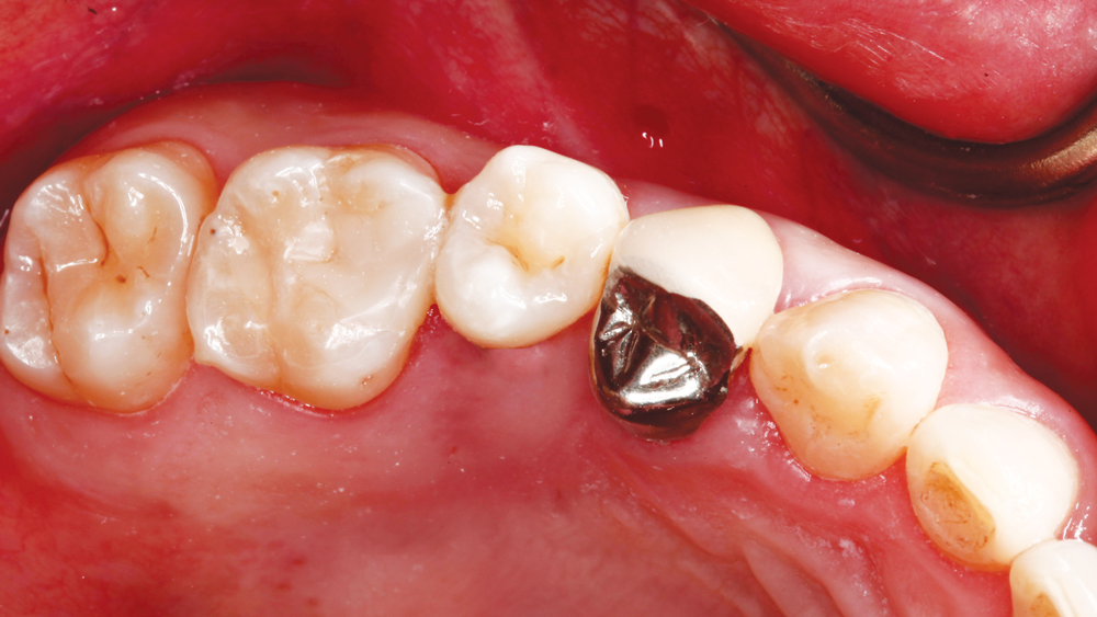 Figure 1a