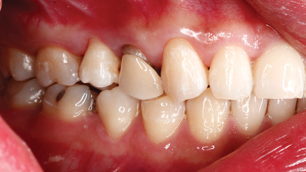 Figure 1b