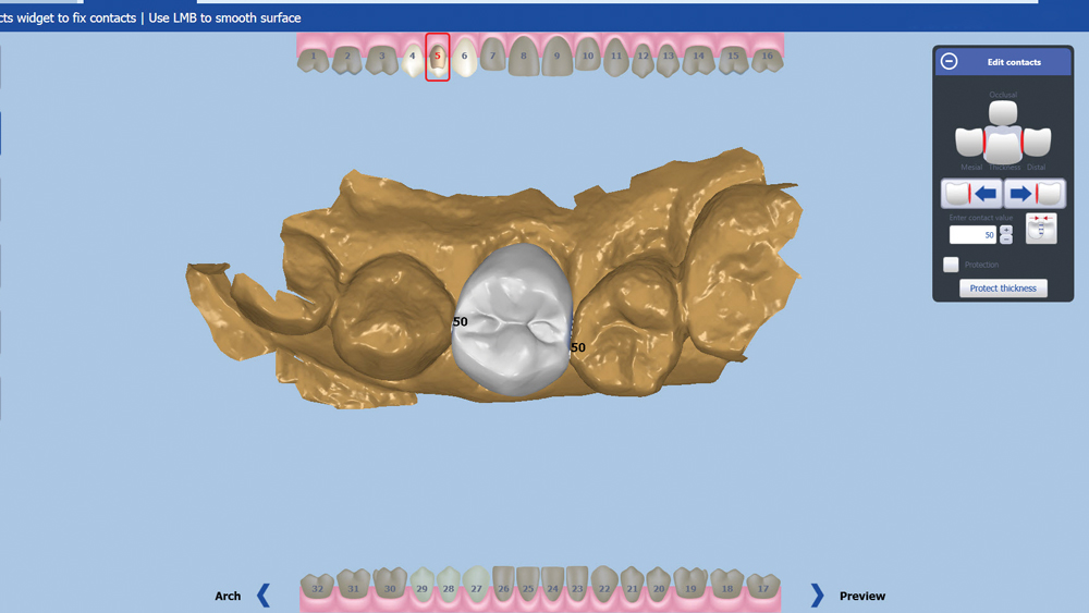 Figure 22b