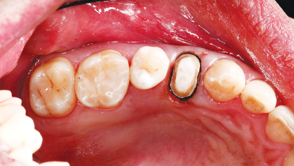 Figure 10