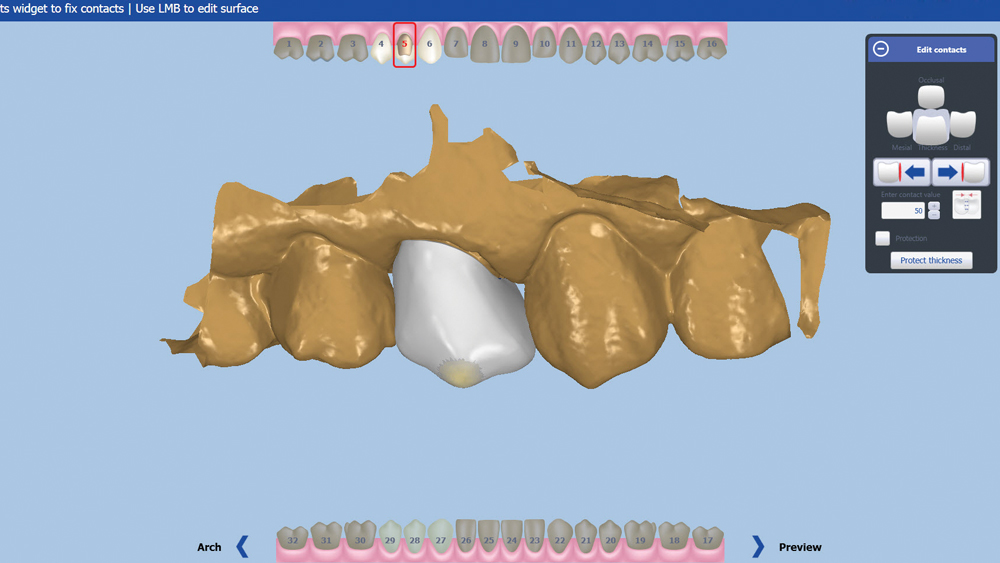 Figure 21