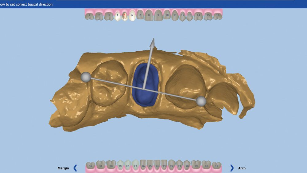 Figure 17