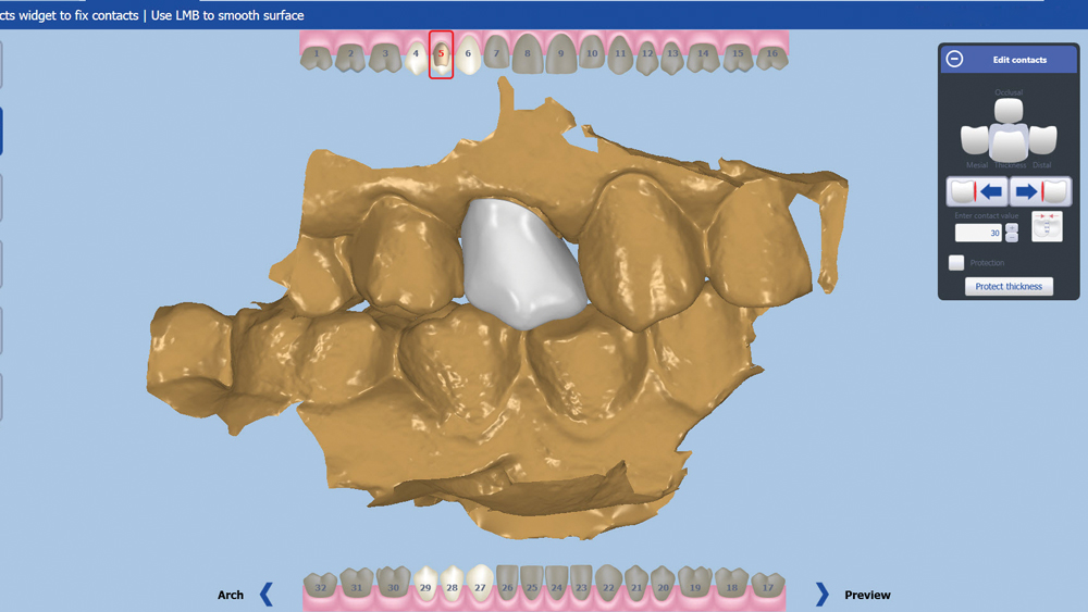 Figure 20
