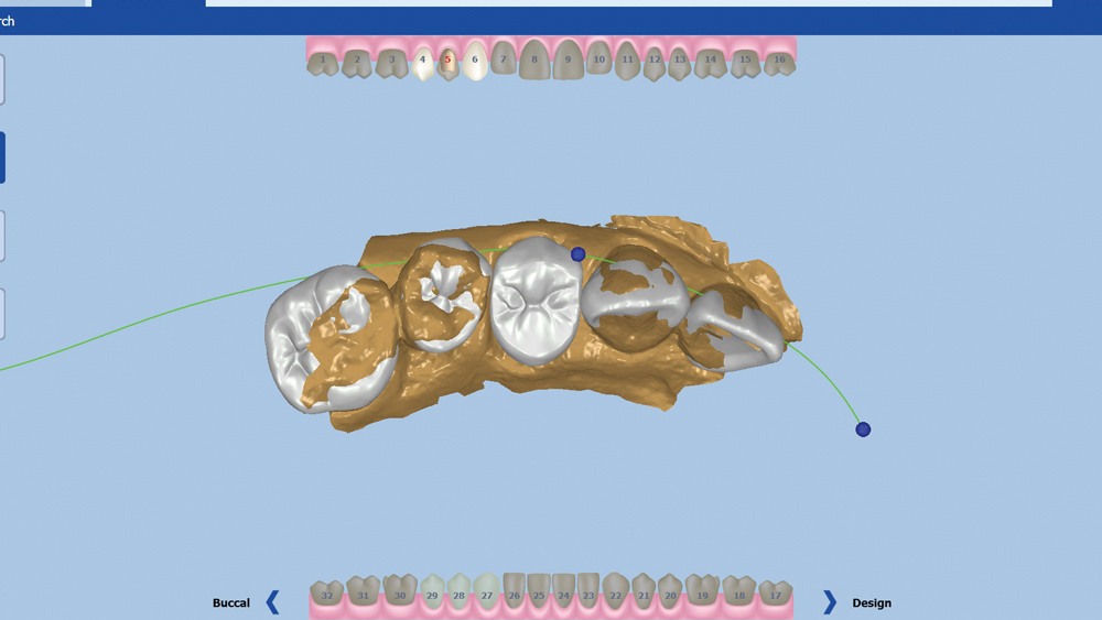 Figure 18