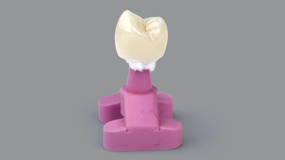 Figure 25a