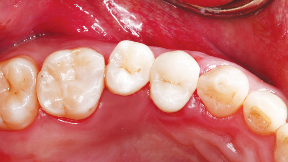 Figure 28a