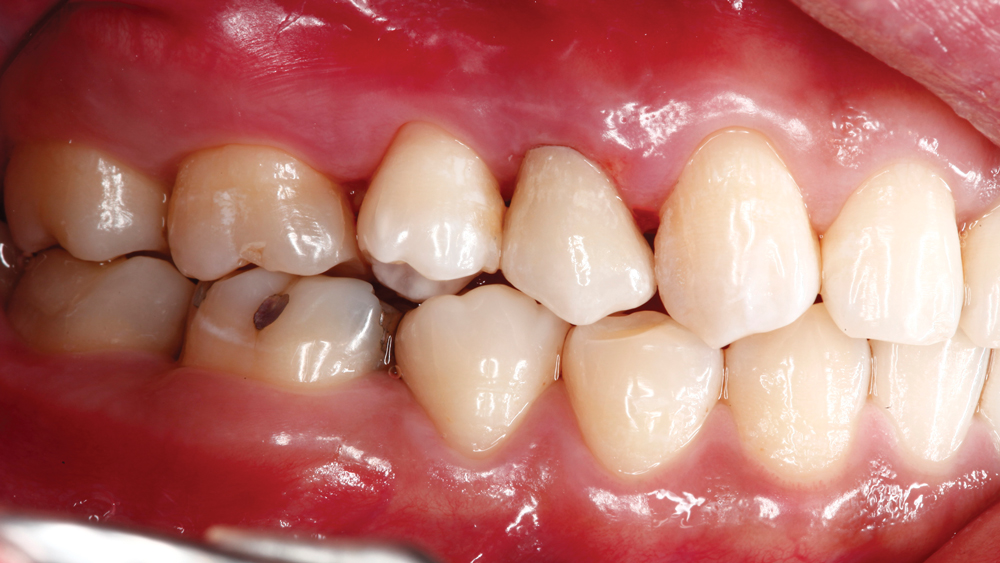Figure 28b