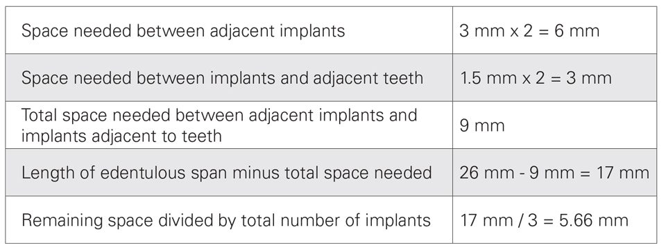 Table showing calculations for required implant spacing