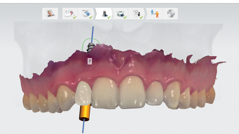 Virtual 3D model of the patient’s mouth
