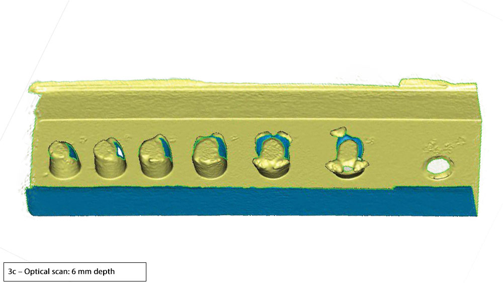 Figure 3c: Optical scan: 6 mm depth