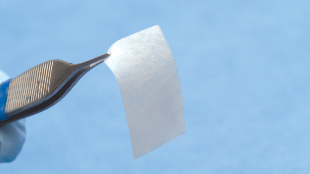 The Use of Barrier Membranes in Implant Dentistry