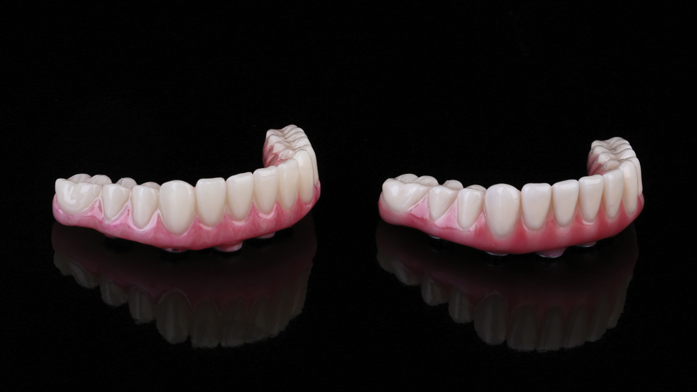 he final mandibular restoration was milled from BruxZir Full-Strength Solid Zirconia. As an exact replica of the patient-confirmed PMMA provisional implant prosthesis (left), the final full-arch BruxZir restoration (right) aligned with the precise expectations of the patient.