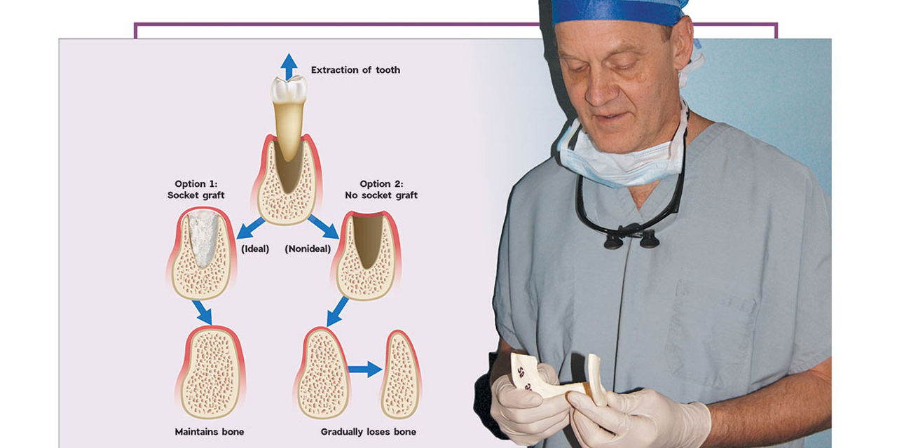 Dr. Resnik next to tooth extraction diagram