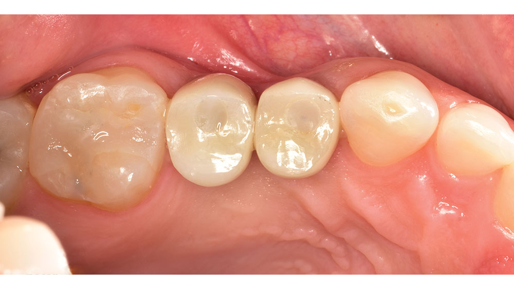 Final outcome of patient with treatment