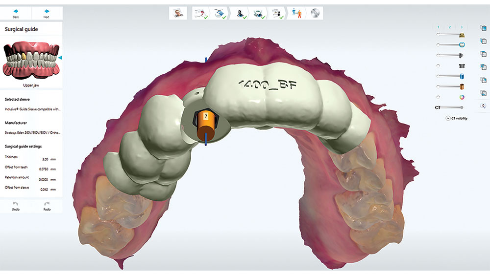 DTP designing surgical guide of precise location of site