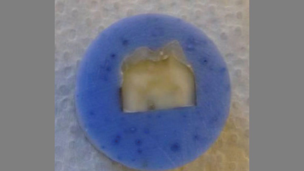 human enamel samples