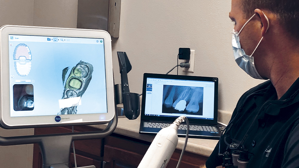 Dr. Buck using the iTero Element intraoral scanner on patient