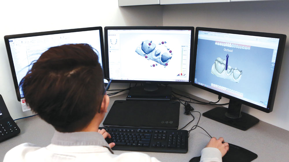 Software displays patient's tooth anatomy in a 3D model